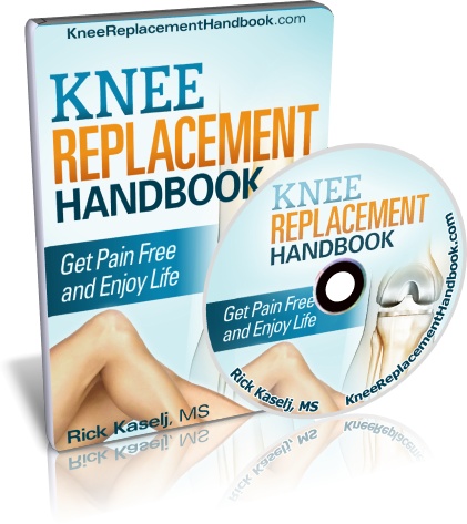 Knee Replacement Handbook
